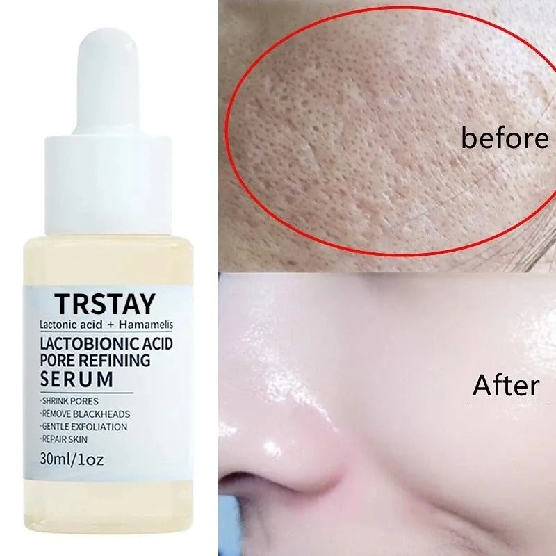 Skin Refining Lactobionic Acid Serum